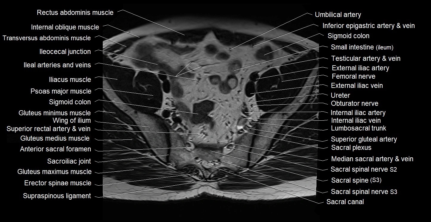 Male pelvis axial cross sectional anatomy image 9.webp